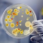 Photo of a petri dish containing resistant bacteria